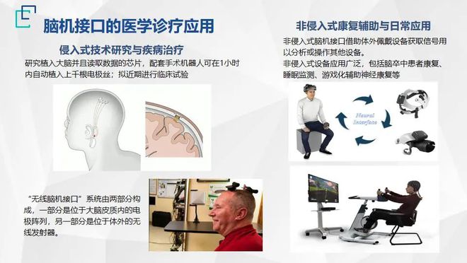 腦科疾病治療迎來(lái)新紀(jì)元 《2022北京醫(yī)工交叉創(chuàng)新戰(zhàn)略前沿技術(shù)十大趨勢(shì)》釋放關(guān)鍵信號(hào)